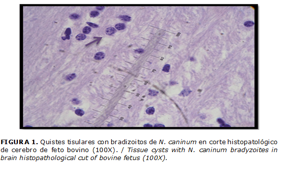 FIGURA 1. Quistes tisulares con bradizoitos de N. caninum en corte histopatológico de cerebro de feto bovino (100X). / Tissue cysts with N. caninum bradyzoites in brain histopathological cut of bovine fetus (100X).